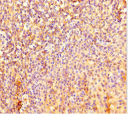 Immunohistochemistry of paraffin-embedded human tonsil tissue using IL4I1 Antibody at dilution of 1:100Rabbit anti-Human IL4I1 Polyclonal Antibody