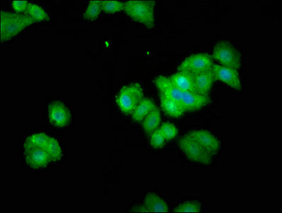 Immunofluorescence staining of HepG2 cells with THEMIS Antibody at 1:100, counter-stained with DAPI. The cells were fixed in 4% formaldehyde, permeabilized using 0.2% Triton X-100 and blocked in 10% normal Goat Serum. The cells were then incubated with the antibody overnight at 4°C. The secondary antibody was Alexa Fluor 488-congugated AffiniPure Goat Anti-Rabbit IgG(H+L).