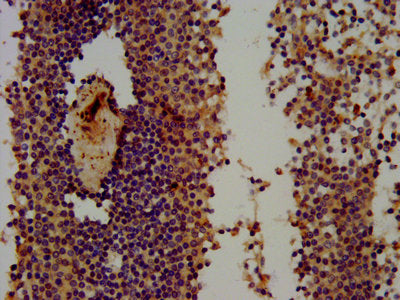IHC image of THEMIS Antibody diluted at 1:300 and staining in paraffin-embedded human spleen tissue performed on a Leica BondTM system. After dewaxing and hydration, antigen retrieval was mediated by high pressure in a citrate buffer (pH 6.0). Section was blocked with 10% normal goat serum 30min at RT. Then primary antibody (1% BSA) was incubated at 4°C overnight. The primary is detected by a biotinylated secondary antibody and visualized using an HRP conjugated SP system.
