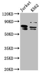 Western Blot  | Positive WB detected in: Jurkat whole cell lysate, K562 whole cell lysate  | All lanes: THEMIS antibody at 7.6µg/ml  | Secondary  | Goat polyclonal to rabbit IgG at 1/50000 dilution  | Predicted band size: 74, 70, 63, 78 kDa  | Observed band size: 74, 70 kDa