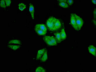 Immunofluorescence staining of HepG2 cells with ARHGAP18 Antibody at 1:66, counter-stained with DAPI. The cells were fixed in 4% formaldehyde, permeabilized using 0.2% Triton X-100 and blocked in 10% normal Goat Serum. The cells were then incubated with the antibody overnight at 4°C. The secondary antibody was Alexa Fluor 488-congugated AffiniPure Goat Anti-Rabbit IgG(H+L).Rabbit anti-Human ARHGAP18 Polyclonal Antibody