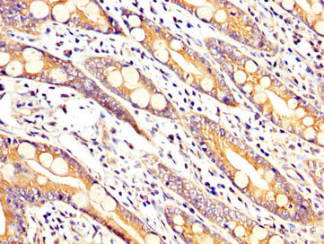 IHC image of ARHGAP18 Antibody diluted at 1:200 and staining in paraffin-embedded human small intestine tissue performed on a Leica BondTM system. After dewaxing and hydration, antigen retrieval was mediated by high pressure in a citrate buffer (pH 6.0). Section was blocked with 10% normal goat serum 30min at RT. Then primary antibody (1% BSA) was incubated at 4°C overnight. The primary is detected by a biotinylated secondary antibody and visualized using an HRP conjugated SP system.Rabbit anti-Human ARHGAP18 Polyclonal Antibody