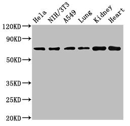 Western Blot  | Positive WB detected in: Hela whole cell lysate, NIH/3T3 whole cell lysate, A549 whole cell lysate, Rat lung tissue, Rat kidney tissue, Mouse heart tissue  | All lanes: ARHGAP18 antibody at 4.5µg/ml  | Secondary  | Goat polyclonal to rabbit IgG at 1/50000 dilution  | Predicted band size: 75, 71 kDa  | Observed band size: 75 kDaRabbit anti-Human ARHGAP18 Polyclonal Antibody