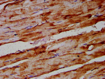 IHC image of ARRDC1 Antibody diluted at 1:400 and staining in paraffin-embedded human skeletal muscle tissue performed on a Leica BondTM system. After dewaxing and hydration, antigen retrieval was mediated by high pressure in a citrate buffer (pH 6.0). Section was blocked with 10% normal goat serum 30min at RT. Then primary antibody (1% BSA) was incubated at 4°C overnight. The primary is detected by a biotinylated secondary antibody and visualized using an HRP conjugated SP system.Rabbit anti-Human ARRDC1 Polyclonal Antibody