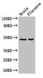 Western Blot | Positive WB detected in: Mouse brain tissue, Human placenta tissue | All lanes: CD177 antibody at 3μg/ml | Secondary | Goat polyclonal to rabbit IgG at 1/50000 dilution | Predicted band size: 47, 28, 16 kDa | Observed band size: 47 kDaRabbit anti-Human CD177 Polyclonal Antibody