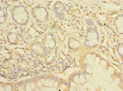 Immunohistochemistry of paraffin-embedded human small intestine tissue using NHLRC2 Antibody at dilution of 1:100Rabbit anti-Human NHLRC2 Polyclonal Antibody