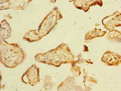 Immunohistochemistry of paraffin-embedded human placenta tissue using NHLRC2 Antibody at dilution of 1:100Rabbit anti-Human NHLRC2 Polyclonal Antibody
