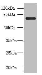 Western blot  | All lanes: NHLRC2 antibody at 8μg/ml + U251 whole cell lysate  | Secondary  | Goat polyclonal to rabbit at 1/10000 dilution  | Predicted band size: 80, 40 kDa  | Observed band size: 80 kDaRabbit anti-Human NHLRC2 Polyclonal Antibody