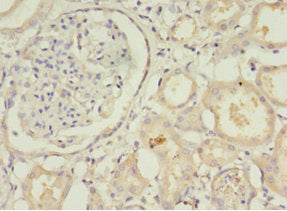 Immunohistochemistry of paraffin-embedded human kidney tissue using STXBP6 Antibody at dilution of 1:100Rabbit anti-Human STXBP6 Polyclonal Antibody