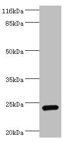 Western blot  | All lanes: STXBP6 antibody at 2μg/ml + Mouse brain tissue  | Secondary  | Goat polyclonal to rabbit at 1/10000 dilution  | Predicted band size: 24, 12 kDa  | Observed band size: 24 kDaRabbit anti-Human STXBP6 Polyclonal Antibody