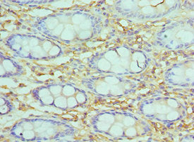 Immunohistochemistry of paraffin-embedded human epityphlon tissue using SMARCC2 Antibody at dilution of 1:100Rabbit anti-Human SMARCC2 Polyclonal Antibody