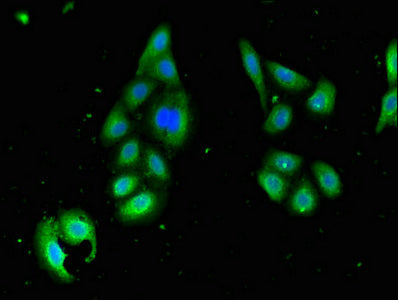 Immunofluorescent analysis of HepG2 cells using STK35 Antibody at dilution of 1:100 and Alexa Fluor 488-congugated AffiniPure Goat Anti-Rabbit IgG(H+L)Rabbit anti-Human STK35 Polyclonal Antibody
