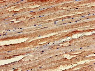 Immunohistochemistry of paraffin-embedded human skeletal muscle tissue using STK35 Antibody at dilution of 1:100Rabbit anti-Human STK35 Polyclonal Antibody