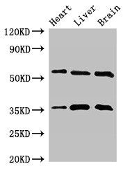 Western Blot | Positive WB detected in: Mouse heart tissue, Mouse liver tissue, Mouse brain tissue | All lanes: STK35 antibody at 2.5μg/ml | Secondary | Goat polyclonal to rabbit IgG at 1/50000 dilution | Predicted band size: 59 kDa | Observed band size: 59, 36 kDaRabbit anti-Human STK35 Polyclonal Antibody