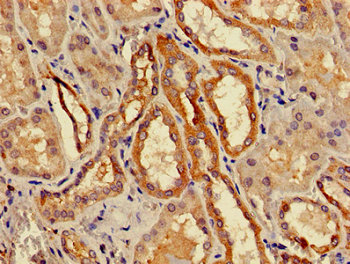 Immunohistochemistry of paraffin-embedded human kidney tissue using ACMSD Antibody at dilution of 1:100