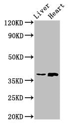 Western Blot | Positive WB detected in: Rat liver tissue, Rat heart tissue | All lanes: ACMSD antibody at 4μg/ml | Secondary | Goat polyclonal to rabbit IgG at 1/50000 dilution | Predicted band size: 39, 32 kDa | Observed band size: 39 kDa