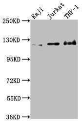 Western Blot | Positive WB detected in: Raji whole cell lysate, Jurkat whole cell lysate, THP-1 whole cell lysate | All lanes: MICAL1 antibody at 1:2000 | Secondary | Goat polyclonal to rabbit IgG at 1/50000 dilution | Predicted band size: 118, 109, 38, 120 kDa | Observed band size: 120 kDa