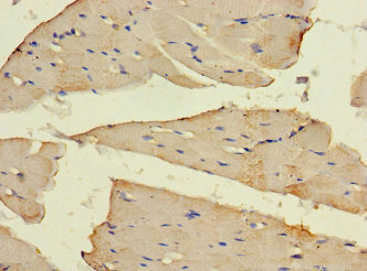 Immunohistochemistry of paraffin-embedded human skeletal muscle tissue using the antibody at dilution of 1:100Rabbit anti-Human SLC16A10 Polyclonal Antibody