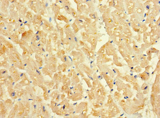 Immunohistochemistry of paraffin-embedded human heart tissue using SLC16A10 Antibody at dilution of 1:100Rabbit anti-Human SLC16A10 Polyclonal Antibody
