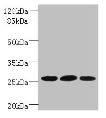 Western blot  | All lanes: Plet1 antibody at 5µg/ml  | Lane 1: L929 whole cell lysate  | Lane 2: U251 whole cell lysate  | Lane 3: Mouse muscle tissue  | Secondary  | Goat polyclonal to rabbit IgG at 1/10000 dilution  | Predicted band size: 26, 21 kDa  | Observed band size: 26 kDaRabbit anti-Mus musculus (Mouse) Plet1 Polyclonal Antibody