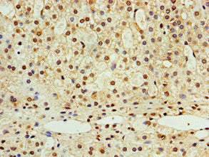 Immunohistochemistry of paraffin-embedded human adrenal gland tissue using STK32A Antibody at dilution of 1:100Rabbit anti-Human STK32A Polyclonal Antibody