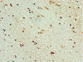 Immunohistochemistry of paraffin-embedded human brain tissue using STK32A Antibody at dilution of 1:100Rabbit anti-Human STK32A Polyclonal Antibody