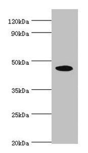 Western blot  | All lanes: STK32A antibody at 5µg/ml + HepG2 whole cell lysate  | Secondary  | Goat polyclonal to rabbit IgG at 1/10000 dilution  | Predicted band size: 47, 20, 42 kDa  | Observed band size: 47 kDaRabbit anti-Human STK32A Polyclonal Antibody