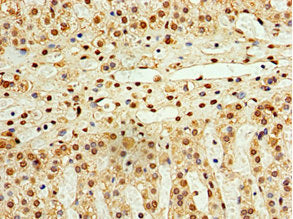 Immunohistochemistry of paraffin-embedded human adrenal gland tissue using STK32A Antibody at dilution of 1:100Rabbit anti-Human STK32A Polyclonal Antibody