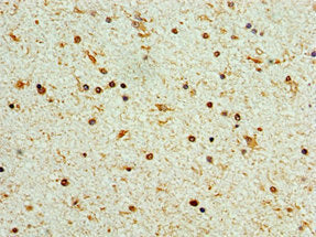 Immunohistochemistry of paraffin-embedded human brain tissue using STK32A Antibody at dilution of 1:100Rabbit anti-Human STK32A Polyclonal Antibody
