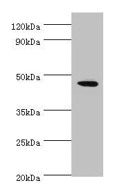 Western blot  | All lanes: STK32A antibody at 2µg/ml + MCF-7 whole cell lysate  | Secondary  | Goat polyclonal to rabbit IgG at 1/10000 dilution  | Predicted band size: 47, 20, 42 kDa  | Observed band size: 47 kDaRabbit anti-Human STK32A Polyclonal Antibody