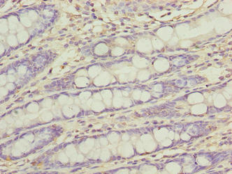 Immunohistochemistry of paraffin-embedded human colon tissue using FAM222B Antibody at dilution of 1:100Rabbit anti-Human FAM222B Polyclonal Antibody