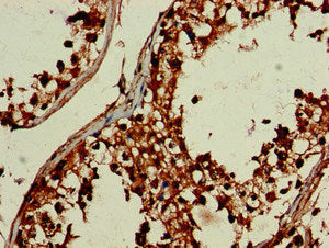 Immunohistochemistry of paraffin-embedded human testis tissue using DEPDC1B Antibody at dilution of 1:100Rabbit anti-Human DEPDC1B Polyclonal Antibody