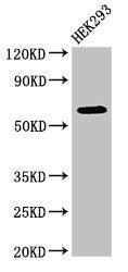Western Blot | Positive WB detected in: HEK293 whole cell lysate | All lanes: DEPDC1B antibody at 4μg/ml | Secondary | Goat polyclonal to rabbit IgG at 1/50000 dilution | Predicted band size: 62, 55 kDa | Observed band size: 62 kDaRabbit anti-Human DEPDC1B Polyclonal Antibody