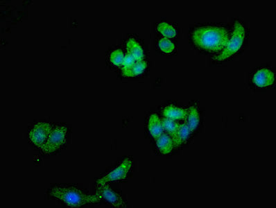 Immunofluorescent analysis of HepG2 cells using ST8SIA2 Antibody at dilution of 1:100 and Alexa Fluor 488-congugated AffiniPure Goat Anti-Rabbit IgG(H+L)Rabbit anti-Human ST8SIA2 Polyclonal Antibody
