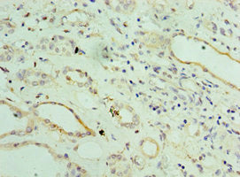 Immunohistochemistry of paraffin-embedded human kidney tissue using ST8SIA2 Antibody at dilution of 1:100Rabbit anti-Human ST8SIA2 Polyclonal Antibody