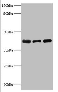 Western blot | All lanes: Alpha-2, 8-sialyltransferase 8B antibody at 8μg/ml | Lane 1: Mouse heart tissue | Lane 2: HepG2 whole cell lysate | Lane 3: Mouse kidney tissue | Secondary | Goat polyclonal to rabbit IgG at 1/10000 dilution | Predicted band size: 42 kDa | Observed band size: 42 kDaRabbit anti-Human ST8SIA2 Polyclonal Antibody