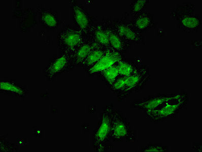 Immunofluorescent analysis of Hela cells using PSMF1 Antibody at dilution of 1:100 and Alexa Fluor 488-congugated AffiniPure Goat Anti-Rabbit IgG(H+L)Rabbit anti-Human PSMF1 Polyclonal Antibody