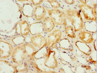 Immunohistochemistry of paraffin-embedded human kidney tissue using PSMF1 Antibody at dilution of 1:100Rabbit anti-Human PSMF1 Polyclonal Antibody
