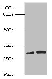 Western blot | All lanes: PSMF1 antibody at 1.28μg/ml | Lane 1: A549 whole cell lysate | Lane 2: K562 whole cell lysate | Secondary | Goat polyclonal to rabbit IgG at 1/10000 dilution | Predicted band size: 30 kDa | Observed band size: 30 kDaRabbit anti-Human PSMF1 Polyclonal Antibody