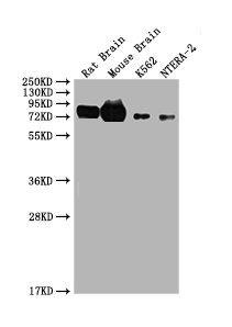 Western Blot | Positive WB detected in: Rat brain tissue, Mouse brain tissue, K562, NTERA-2 | All lanes: WASF1 antibody at 1.5μg/ml | Secondary | Goat polyclonal to rabbit IgG at 1/50000 dilution | Predicted band size: 80 kDa | Observed band size: 62 kDaRabbit anti-Human WASF1 Polyclonal Antibody