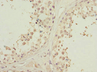 Immunohistochemistry of paraffin-embedded human testis tissue using PIK3R3 Antibody at dilution of 1:100Rabbit anti-Human PIK3R3 Polyclonal Antibody