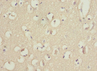 Immunohistochemistry of paraffin-embedded human brain tissue using PIK3R3 Antibody at dilution of 1:100Rabbit anti-Human PIK3R3 Polyclonal Antibody