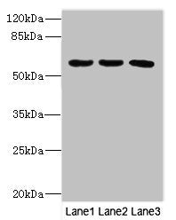 Western blot | All lanes: PIK3R3 antibody at 3.5μg/ml | Lane 1: MCF-7 whole cell lysate | Lane 2: Jurkat whole cell lysate | Lane 3: Mouse gonadal tissue | Secondary | Goat polyclonal to rabbit IgG at 1/10000 dilution | Predicted band size: 55, 48, 44 kDa | Observed band size: 55 kDaRabbit anti-Human PIK3R3 Polyclonal Antibody