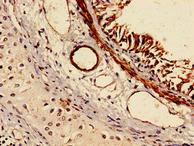 IHC image of RABGGTA Antibody diluted at 1:150 and staining in paraffin-embedded human lung tissue performed on a Leica BondTM system. After dewaxing and hydration, antigen retrieval was mediated by high pressure in a citrate buffer (pH 6.0). Section was blocked with 10% normal goat serum 30min at RT. Then primary antibody (1% BSA) was incubated at 4°C overnight. The primary is detected by a biotinylated secondary antibody and visualized using an HRP conjugated SP system.Rabbit anti-Human RABGGTA Polyclonal Antibody