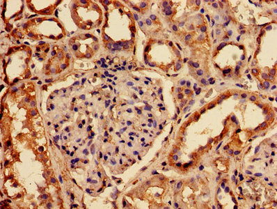 IHC image of RABGGTA Antibody diluted at 1:150 and staining in paraffin-embedded human kidney tissue performed on a Leica BondTM system. After dewaxing and hydration, antigen retrieval was mediated by high pressure in a citrate buffer (pH 6.0). Section was blocked with 10% normal goat serum 30min at RT. Then primary antibody (1% BSA) was incubated at 4°C overnight. The primary is detected by a biotinylated secondary antibody and visualized using an HRP conjugated SP system.Rabbit anti-Human RABGGTA Polyclonal Antibody