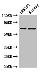 Western BlotPositive WB detected in: HEK293 whole cell lysate, Mouse kidney tissueAll lanes: RABGGTA antibody at 1.5μg/mlSecondaryGoat polyclonal to rabbit IgG at 1/50000 dilutionPredicted band size: 66 kDaObserved band size: 66 kDaRabbit anti-Human RABGGTA Polyclonal Antibody