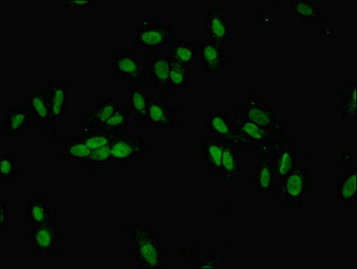 Immunofluorescent analysis of Hela cells using JARID2 Antibody at dilution of 1:100 and Alexa Fluor 488-congugated AffiniPure Goat Anti-Rabbit IgG(H+L)