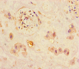 Immunohistochemistry of paraffin-embedded human placenta tissue using JARID2 Antibody at dilution of 1:100