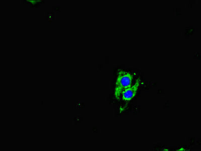 Immunofluorescent analysis of Hela cells using NEO1 Antibody at dilution of 1:100 and Alexa Fluor 488-congugated AffiniPure Goat Anti-Rabbit IgG(H+L)Rabbit anti-Human NEO1 Polyclonal Antibody