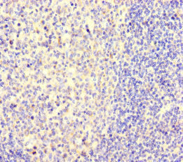 Immunohistochemistry of paraffin-embedded human tonsil tissue using NEO1 Antibody at dilution of 1:100Rabbit anti-Human NEO1 Polyclonal Antibody